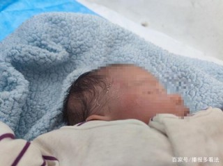 樂山剛出生40天的嬰兒被放風箏的小孩踩傷頭部，現還在醫院治療