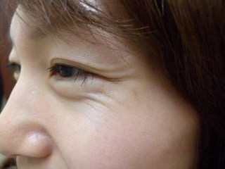 眼部問題不會等到25歲才找上門，聰明女人懂得如何贏在起跑線上