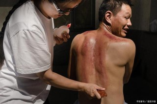 刮痧要注意這6點，還要搞明白不出痧的原因，才能更好的養生保健