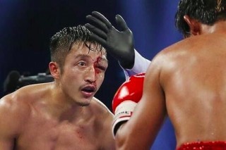鄒市明眼睛重創，桑蘭17歲高位截癱，還有運動員終身不孕