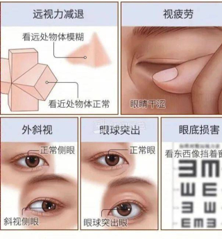 要開學了，娃近視多少度需要戴眼鏡？_孩子_家長_程度
