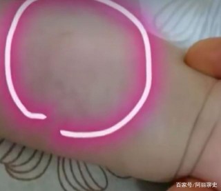 又一起！天降煙灰杯砸傷3個月嬰兒，小區貼200張告示尋拋物者