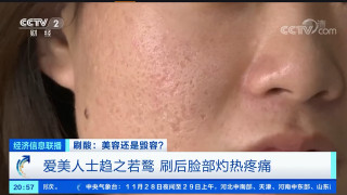 女子美容院刷酸後流膿爛臉，專家建議：刷酸需在醫療機構進行
