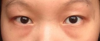 姑媽眼袋久久不能撫平，一瓶小蘇打配上「它」，三天輕鬆撫平眼袋