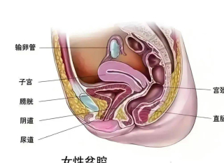 成年女性慢性盆腔痛，你了解多少？_檢查_患者_醫