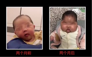 女嬰用寶寶霜變“大頭娃娃” 醫生教你安全選購嬰幼兒護膚品