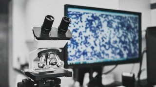 科學家利用幹細胞修復患帕金森病小鼠受損神經