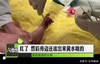 寶寶險被截肢，每隔1小時放一次血，罪魁禍首竟是媽媽身上的東西