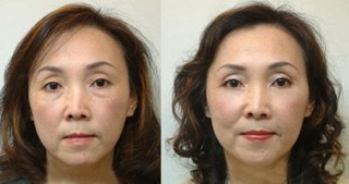 屈臣氏有個「牛貨」，輕鬆解決眼袋去皺紋不在話下，千萬人瘋搶