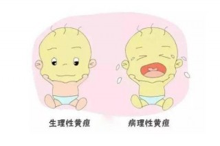 寶寶在嬰兒期有黃疸怎麼辦？