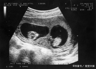 狗血！夫妻進行試管嬰兒，孩子的父親竟然是他的親兄弟