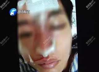 體下抽脂、垃圾填充：你以為的「微整形」，其實是「危整形」