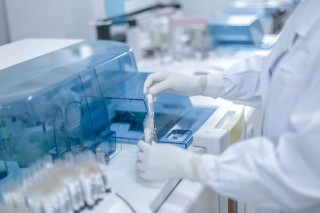 科學家發現來自sars倖存者的血液產生了一種中和新冠狀病毒的抗體