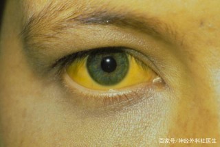 31歲女白領查出肝癌，失聲痛哭，身體早已提醒，只是被她忽視了
