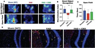 腦科學日報：國內首個Aβ抗體獲批臨床試驗，治療阿爾茨海默症