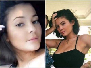 卡戴珊小妹「厚唇消失」獲贊 曝豐唇因被嘲笑接吻差