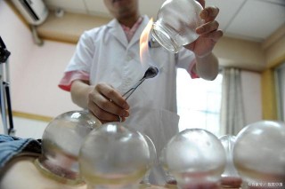 刮痧、拔罐、推拿……大眾熟知的養生保健方式，應注意什麼？（下）